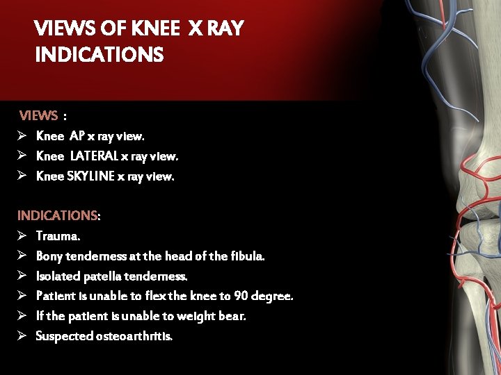 VIEWS OF KNEE X RAY INDICATIONS VIEWS : Ø Knee AP x ray view. VIEWS OF KNEE X RAY INDICATIONS VIEWS : Ø Knee AP x ray view.