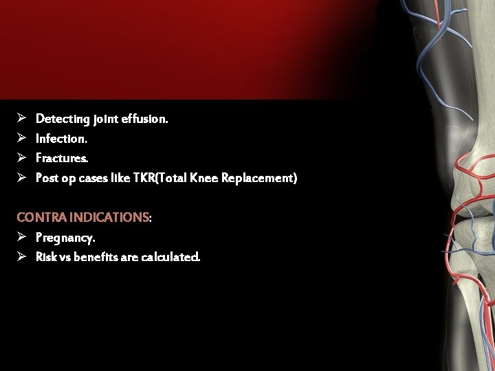 Ø Ø Detecting joint effusion. Infection. Fractures. Post op cases like TKR(Total Knee Replacement) Ø Ø Detecting joint effusion. Infection. Fractures. Post op cases like TKR(Total Knee Replacement)