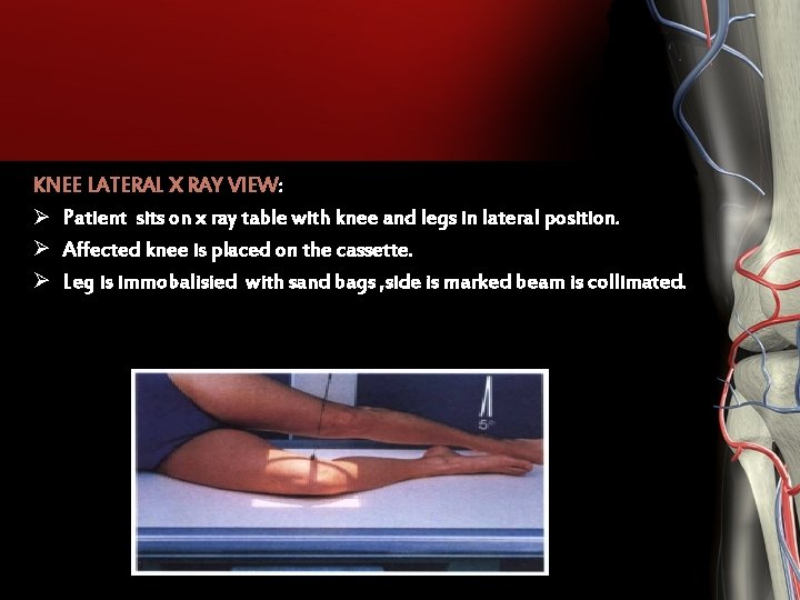 KNEE LATERAL X RAY VIEW: Ø Patient sits on x ray table with knee KNEE LATERAL X RAY VIEW: Ø Patient sits on x ray table with knee