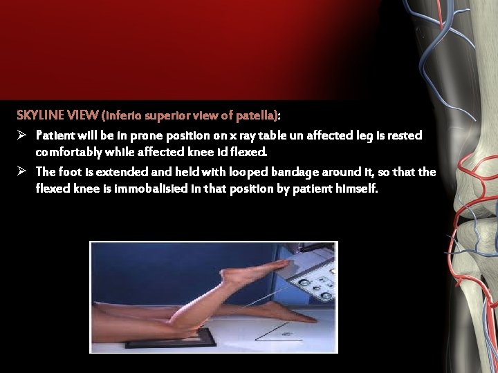SKYLINE VIEW (inferio superior view of patella): Ø Patient will be in prone position SKYLINE VIEW (inferio superior view of patella): Ø Patient will be in prone position