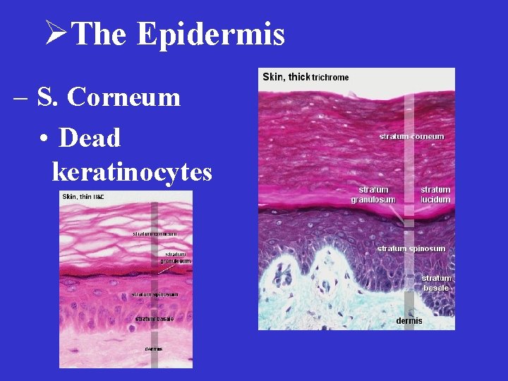 ØThe Epidermis – S. Corneum • Dead keratinocytes 
