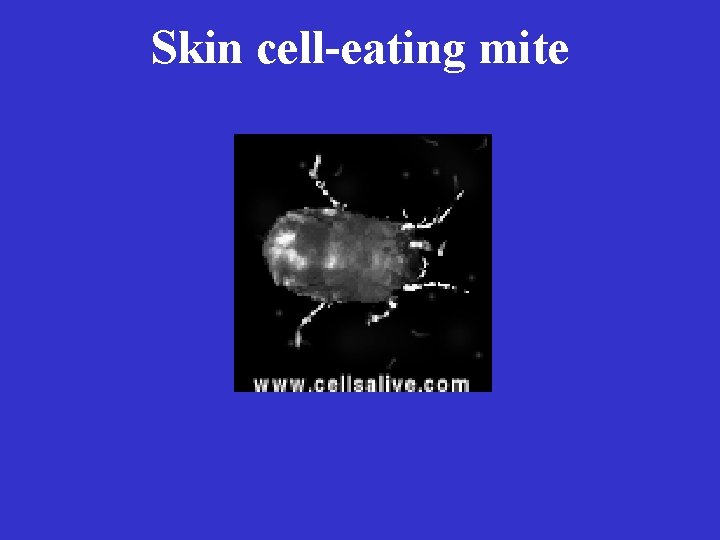 Skin cell-eating mite 