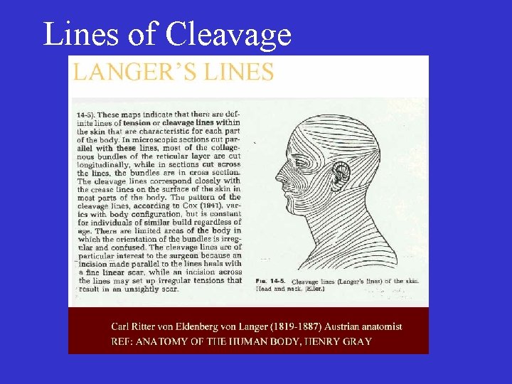 Lines of Cleavage • 