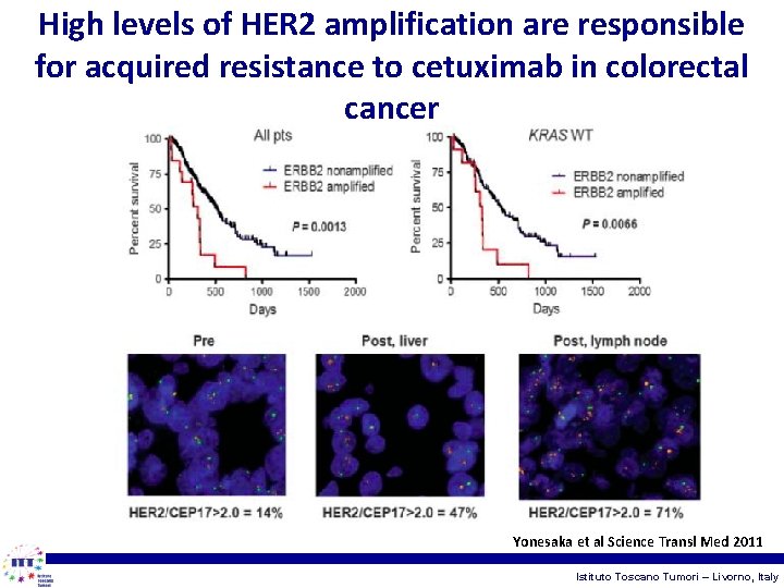 High levels of HER 2 amplification are responsible for acquired resistance to cetuximab in