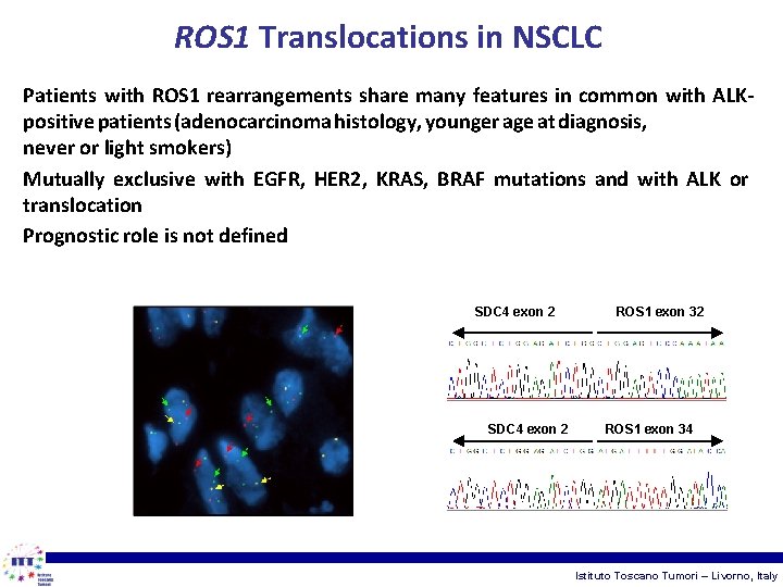 ROS 1 Translocations in NSCLC Patients with ROS 1 rearrangements share many features in