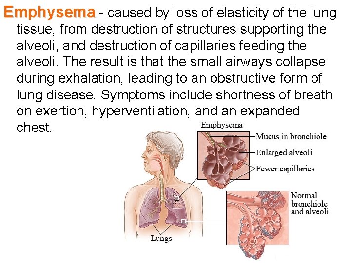 Emphysema - caused by loss of elasticity of the lung tissue, from destruction of
