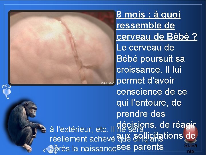 8 mois : à quoi ressemble de cerveau de Bébé ? Le cerveau de