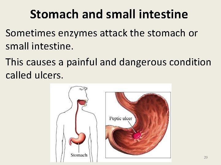 Stomach and small intestine Sometimes enzymes attack the stomach or small intestine. This causes