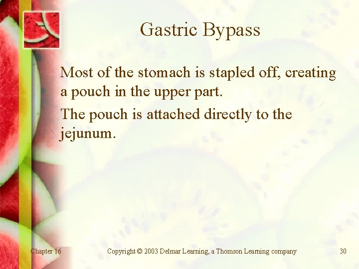 Gastric Bypass Most of the stomach is stapled off, creating a pouch in the