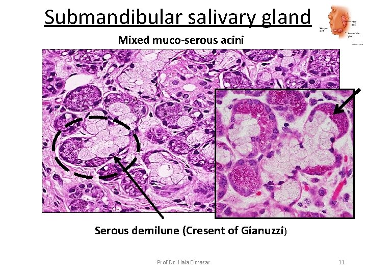 Submandibular salivary gland Mixed muco-serous acini Serous demilune (Cresent of Gianuzzi) Prof Dr. Hala