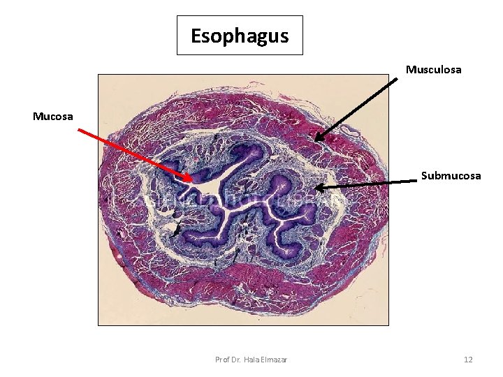 Esophagus Musculosa Mucosa Submucosa Prof Dr. Hala Elmazar 12 