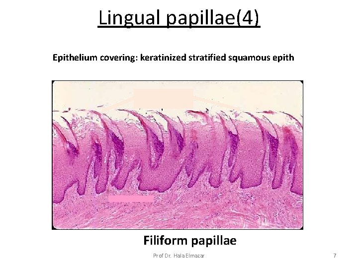 Lingual papillae(4) Epithelium covering: keratinized stratified squamous epith Filiform papillae Prof Dr. Hala Elmazar