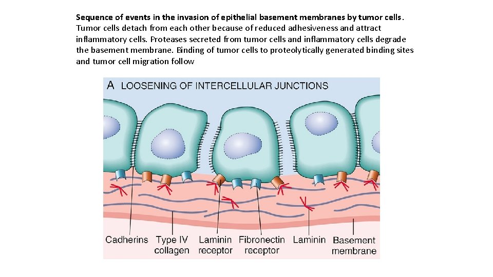 Sequence of events in the invasion of epithelial basement membranes by tumor cells. Tumor