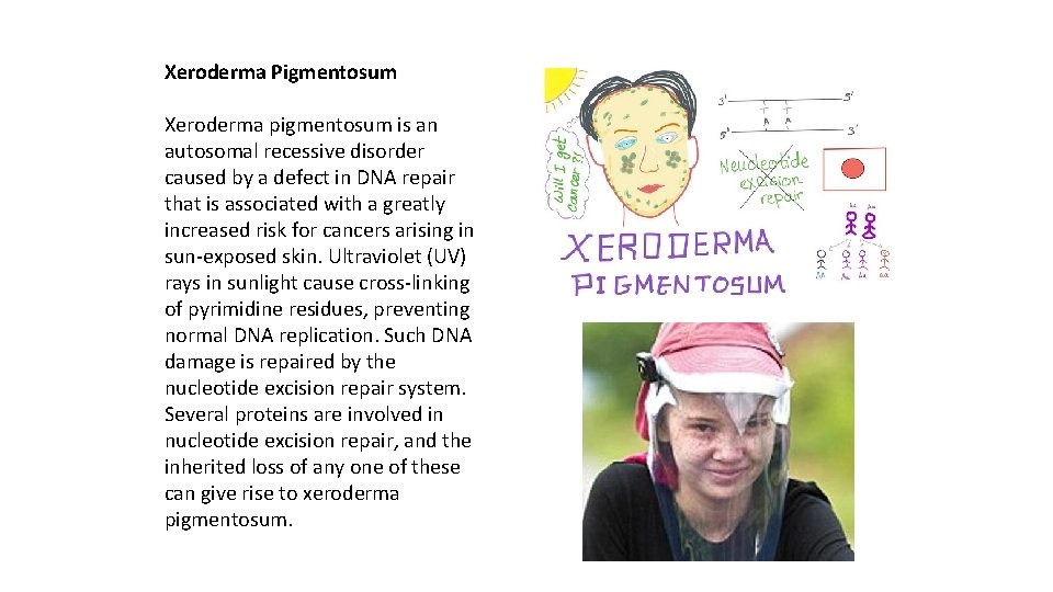 Xeroderma Pigmentosum Xeroderma pigmentosum is an autosomal recessive disorder caused by a defect in