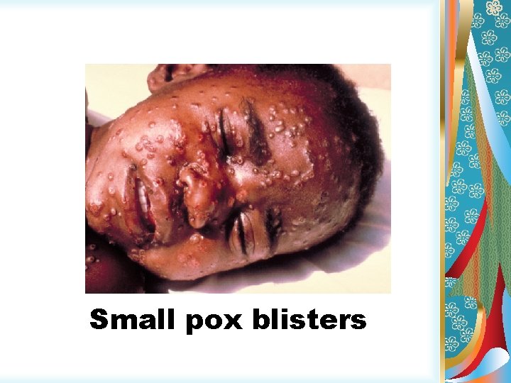 Small pox blisters 