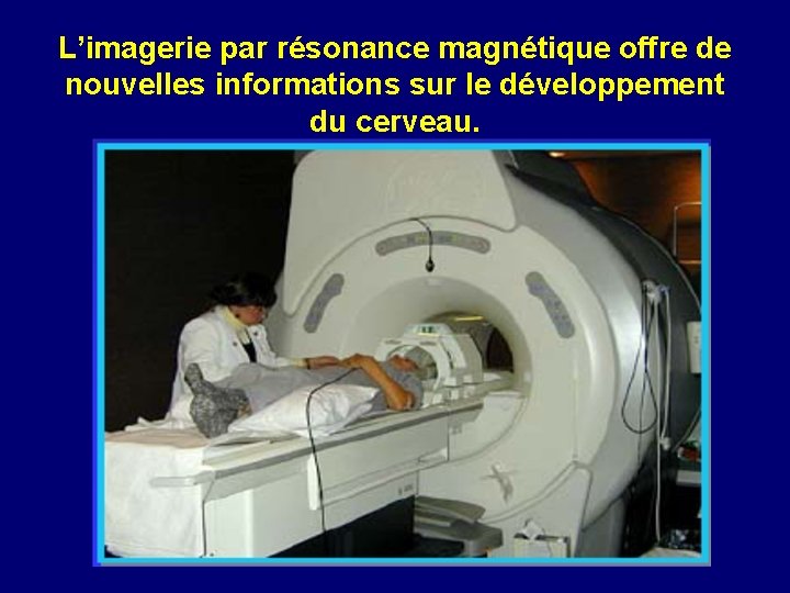 L’imagerie par résonance magnétique offre de nouvelles informations sur le développement du cerveau. 