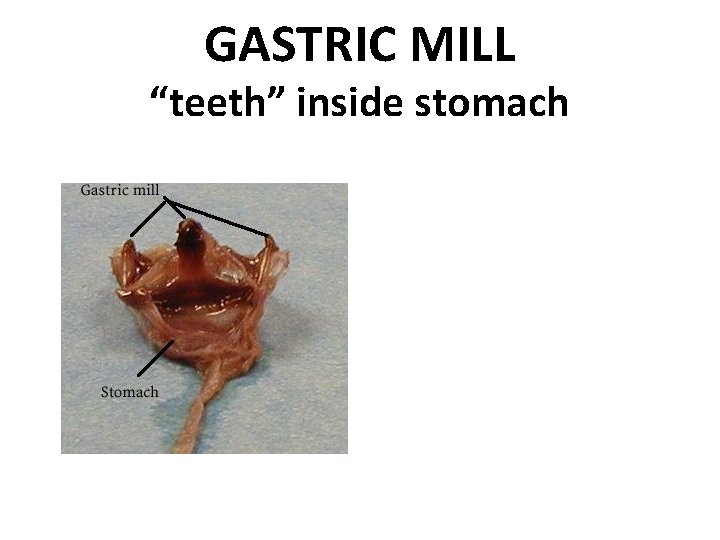 GASTRIC MILL “teeth” inside stomach 