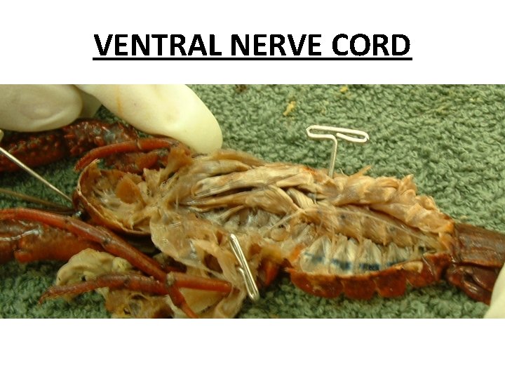 VENTRAL NERVE CORD 
