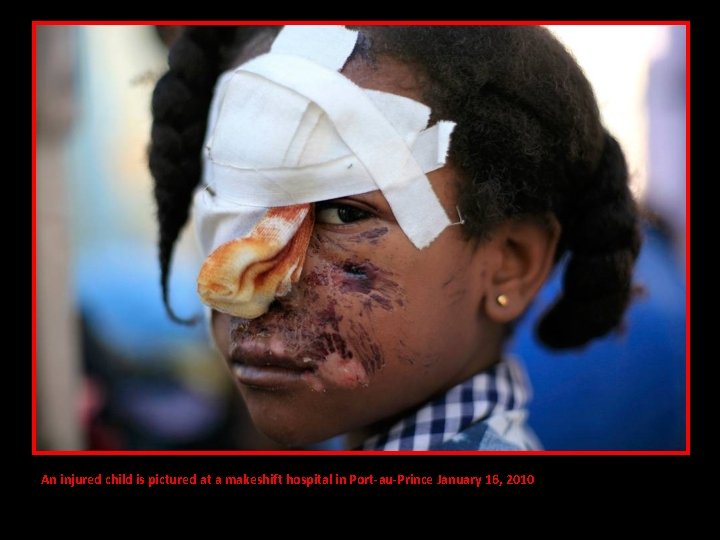 An injured child is pictured at a makeshift hospital in Port-au-Prince January 16, 2010