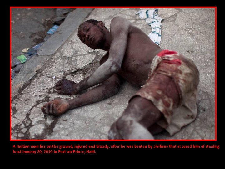 A Haitian man lies on the ground, injured and bloody, after he was beaten