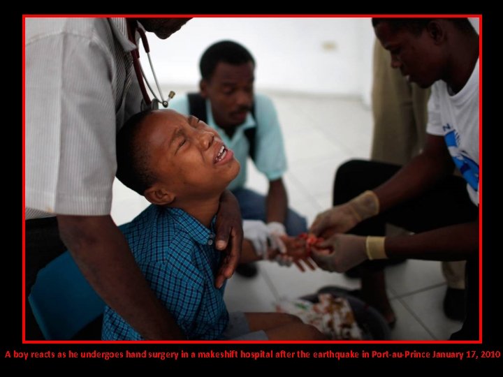 A boy reacts as he undergoes hand surgery in a makeshift hospital after the