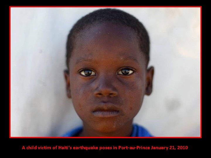 A child victim of Haiti's earthquake poses in Port-au-Prince January 21, 2010 