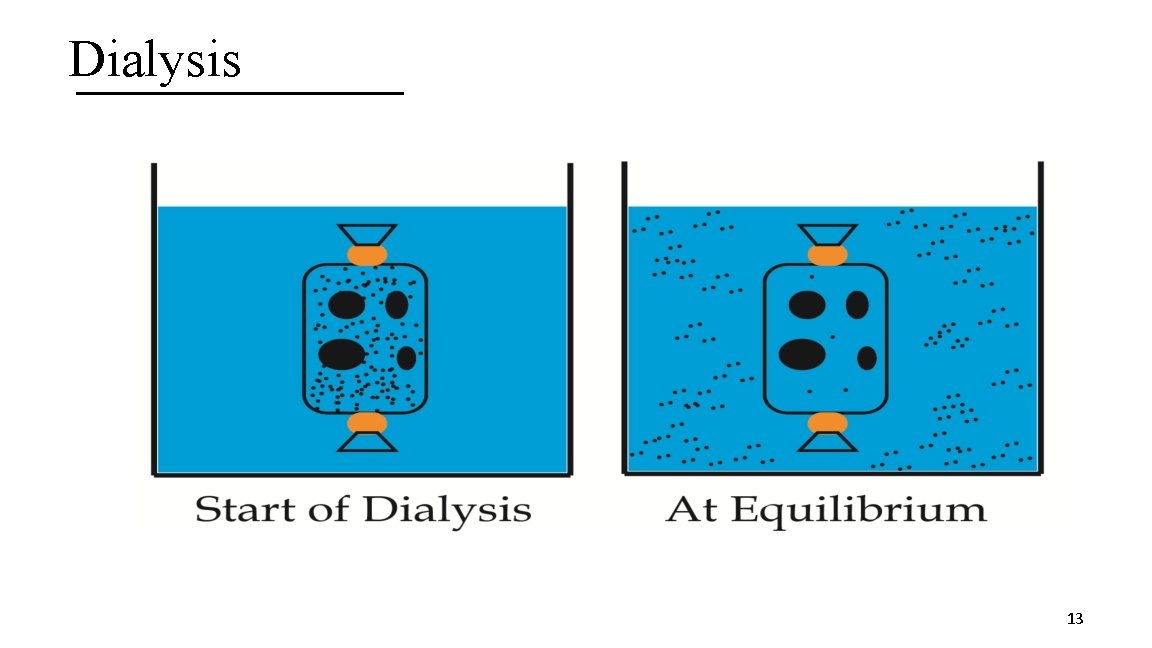 Dialysis 13 