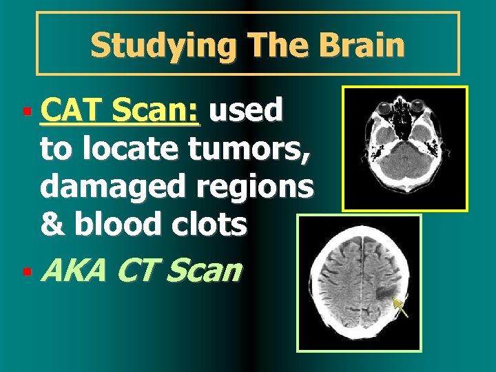 Studying The Brain CAT Scan: used to locate tumors, damaged regions & blood clots