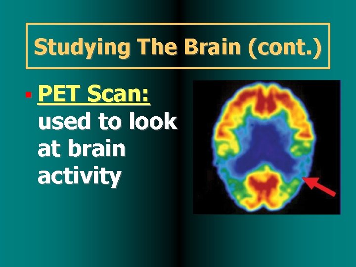 Studying The Brain (cont. ) PET Scan: used to look at brain activity 