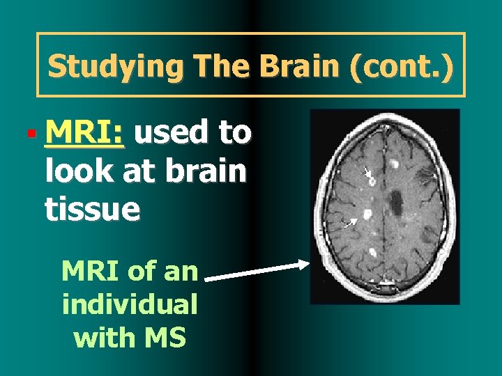 Studying The Brain (cont. ) MRI: used to look at brain tissue MRI of