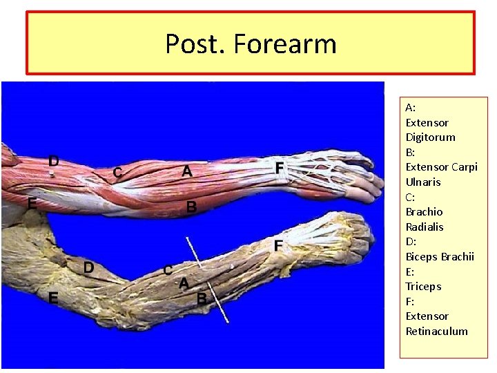 Post. Forearm A: Extensor Digitorum B: Extensor Carpi Ulnaris C: Brachio Radialis D: Biceps
