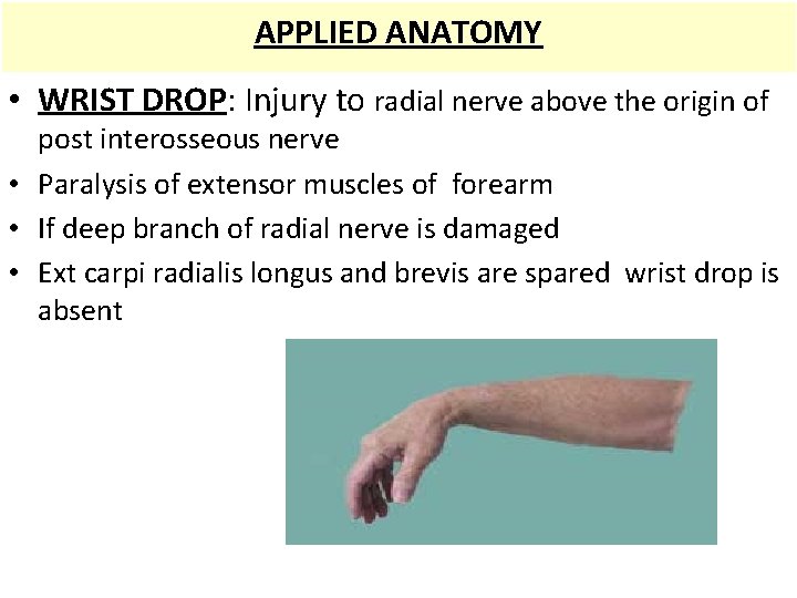 APPLIED ANATOMY • WRIST DROP: Injury to radial nerve above the origin of post