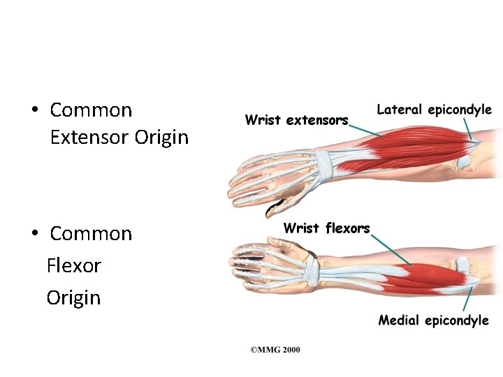  • Common Extensor Origin • Common Flexor Origin 