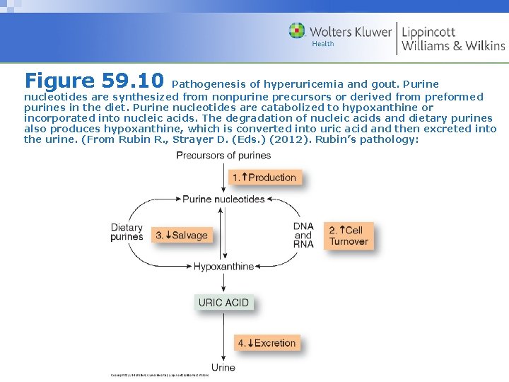 Figure 59. 10 Pathogenesis of hyperuricemia and gout. Purine nucleotides are synthesized from nonpurine