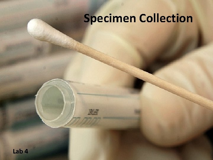 Specimen Collection Lab 4 