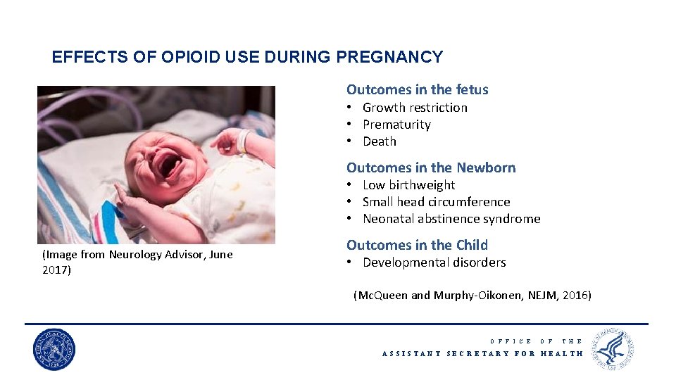 EFFECTS OF OPIOID USE DURING PREGNANCY Outcomes in the fetus • Growth restriction •