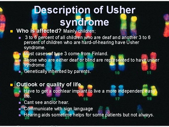 Description of Usher syndrome n Who is affected? Mainly children; n n n 3