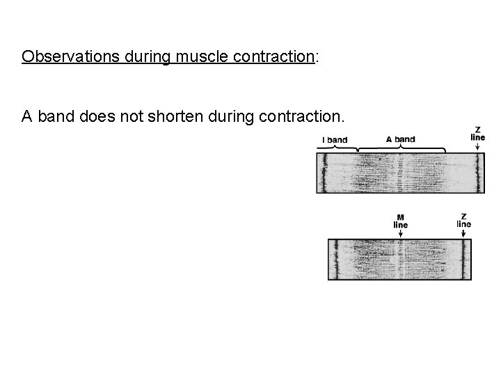 Observations during muscle contraction: A band does not shorten during contraction. 