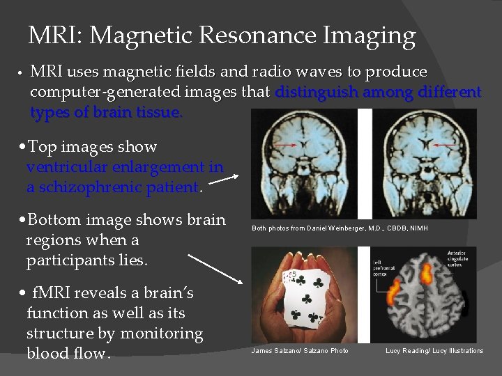 MRI: Magnetic Resonance Imaging • MRI uses magnetic fields and radio waves to produce