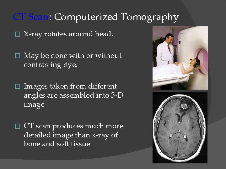 CT Scan: Computerized Tomography � X-ray rotates around head. � May be done with