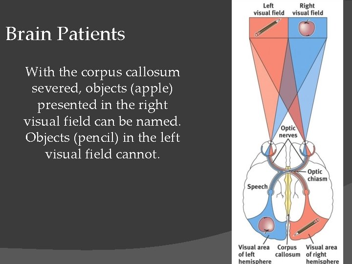 t Brain Patients With the corpus callosum severed, objects (apple) presented in the right