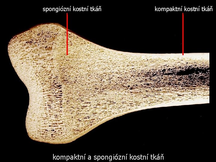 spongiózní kostní tkáň kompaktní a spongiózní kostní tkáň 