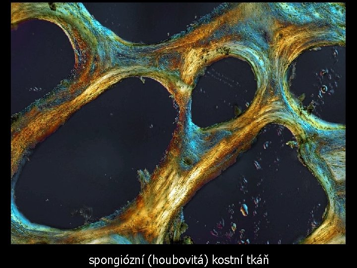 spongiózní (houbovitá) kostní tkáň 