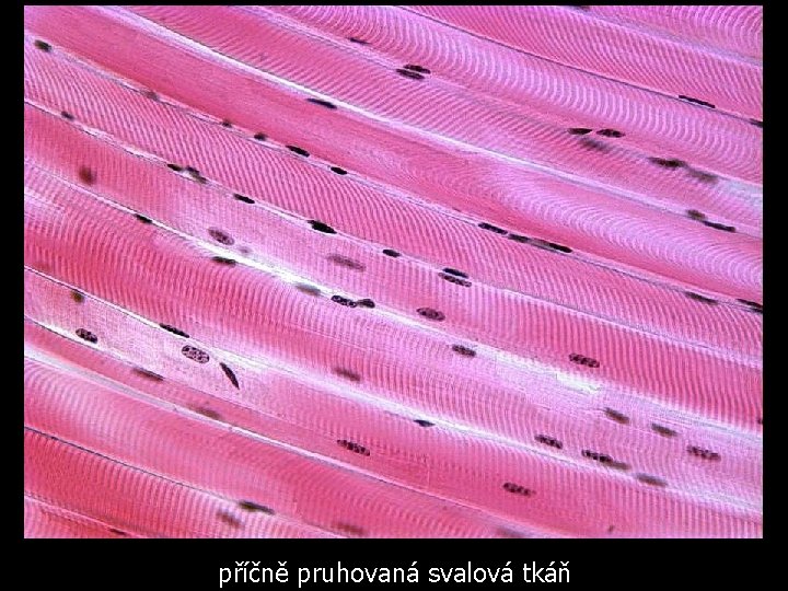 příčně pruhovaná svalová tkáň 