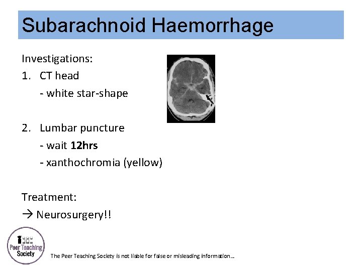 Subarachnoid Haemorrhage Investigations: 1. CT head - white star-shape 2. Lumbar puncture - wait