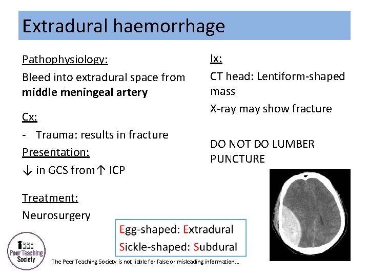 Extradural haemorrhage Pathophysiology: Bleed into extradural space from middle meningeal artery Cx: - Trauma: