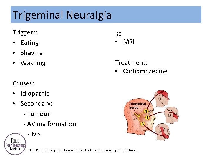 Trigeminal Neuralgia Triggers: • Eating • Shaving • Washing Ix: • MRI Treatment: •