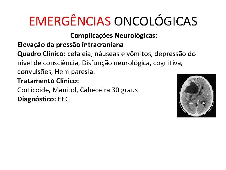 EMERGÊNCIAS ONCOLÓGICAS Complicações Neurológicas: Elevação da pressão intracraniana Quadro Clínico: cefaleia, náuseas e vômitos,