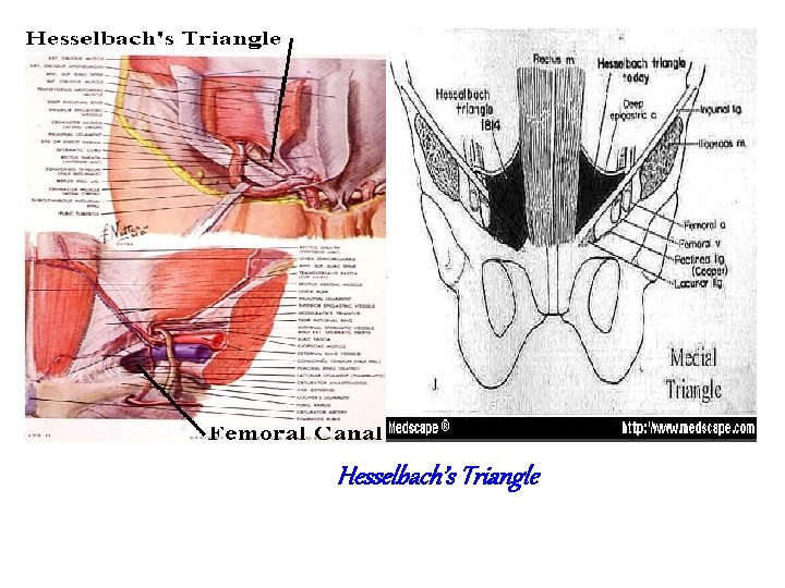 Abdominal wall hernias Hernia General Principle Of External