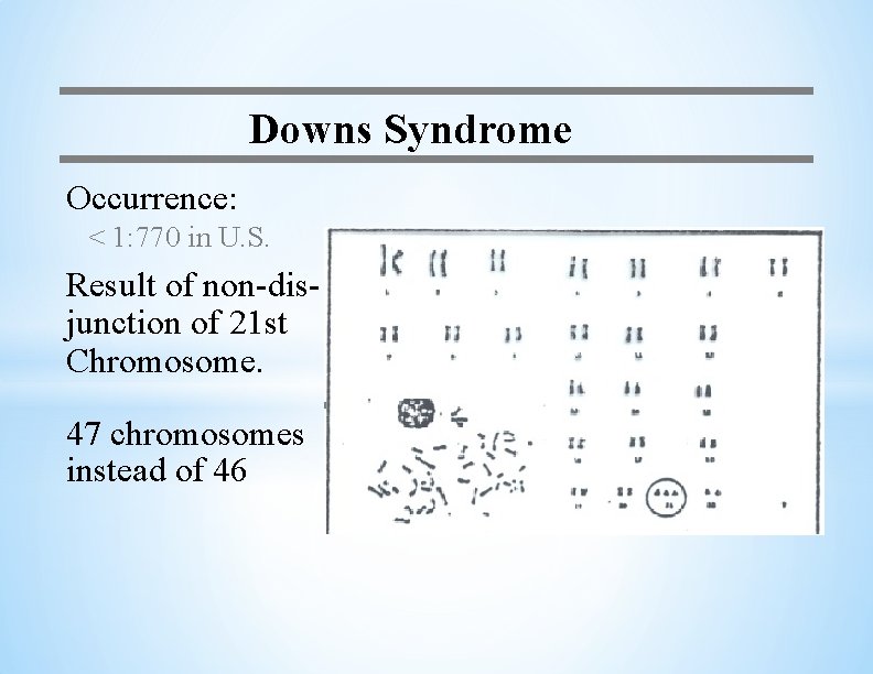 Downs Syndrome Occurrence: < 1: 770 in U. S. Result of non-disjunction of 21